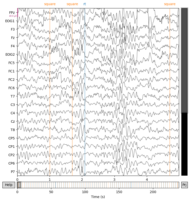 Eeg Spectrum Patterns gettingstarted – EEGDUCKS